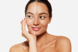 Summer Tan Removal